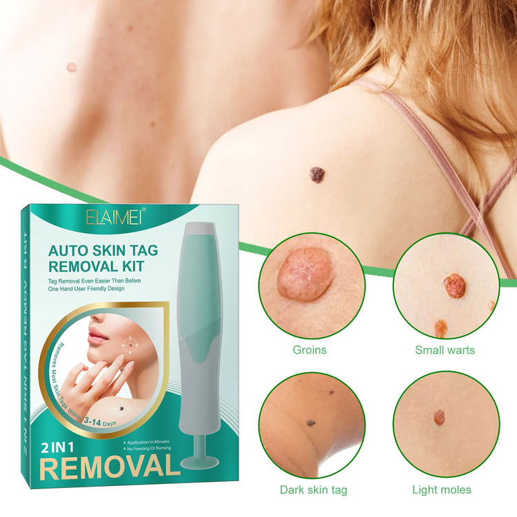 Auto Skin Tag Removal Kit 2-8mm Body Facial Beauty Tool